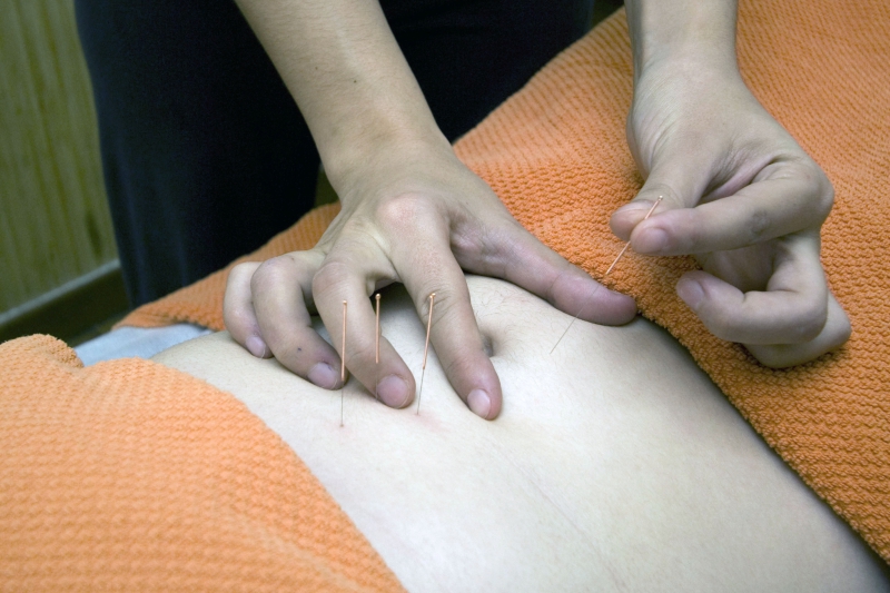 osteopathe-OLLIERES-min_acupuncture-4175625